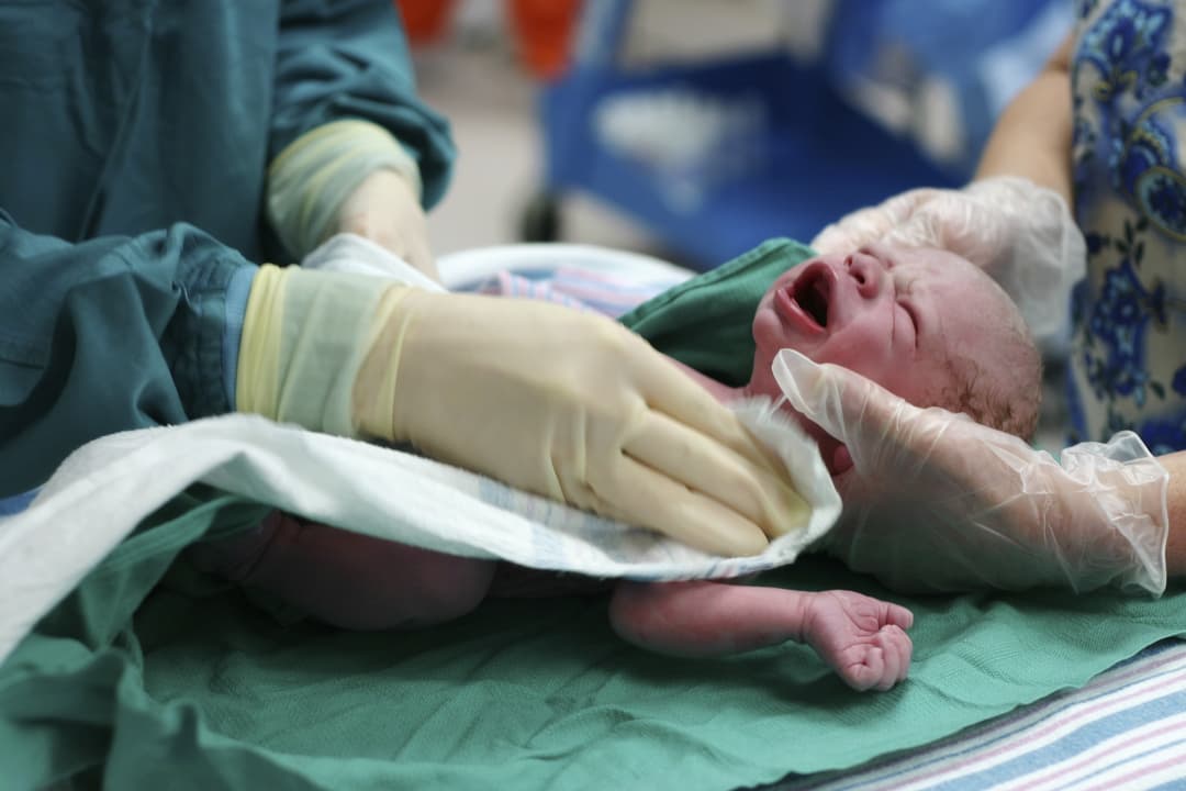 اليرقان النووي: الأسباب والأعراض والتشخيص والعلاج
