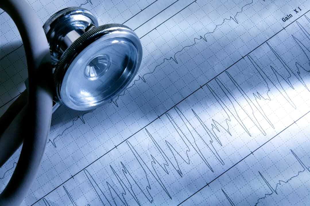 فرط البوتاسيوم: الأسباب والعلاج