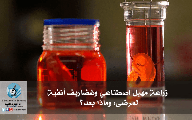 زراعة مهبل اصطناعي وغضاريف أنفية لمرضى: وماذا بعد؟