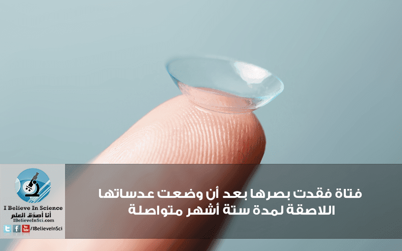 فتاة فقدت بصرها بعد أن وضعت عدساتها اللاصقة لمدة ستة أشهر متواصلة