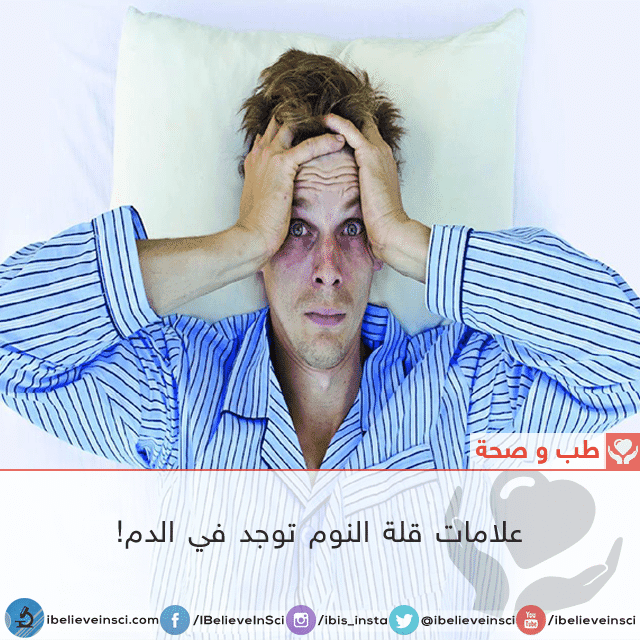 علامات قلة النوم توجد في الدم!