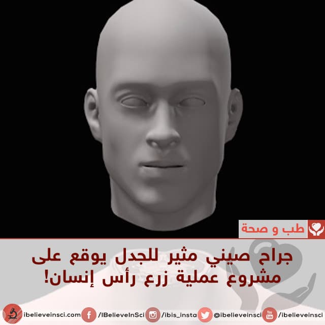 جراح صيني مثير للجدل يوقع على مشروع عملية زرع رأس إنسان!