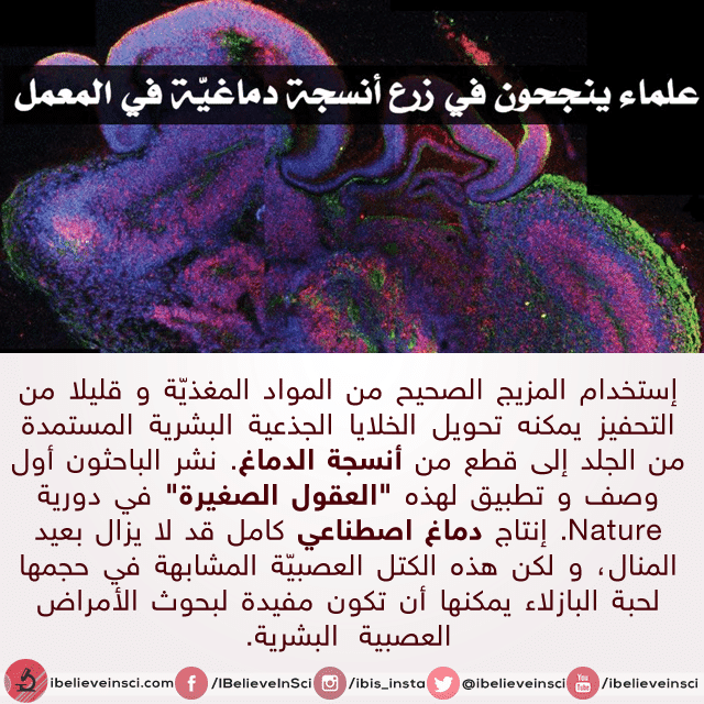 علماء ينجحون في زرع أنسجة دماغية في المعمل