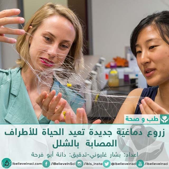 زروع دماغيّة جديدة تعيد الحياة للأطراف المصابة بالشلل