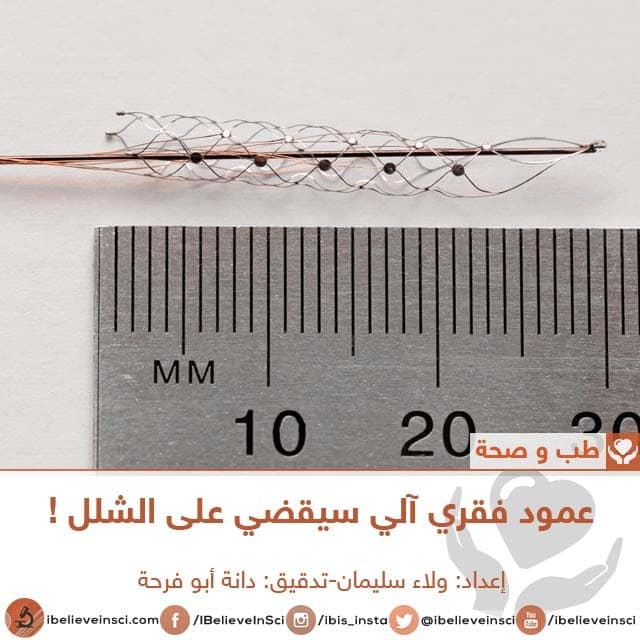 عمود فقري آلي سيقضي على الشلل !