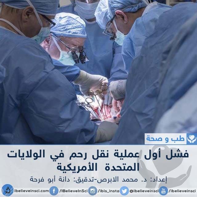 فشل أول عملية نقل رحم في الولايات المتحدة الأمريكية