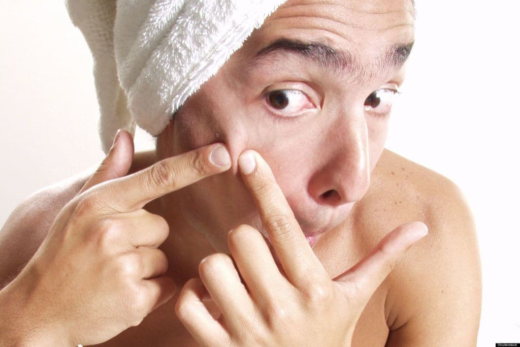 كيف تتعامل مع البثور على وجهك؟ لا تعصرها بل اقرأ المقالة!