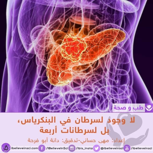 سرطان البنكرياس مكوّن من أربعة أنواع منفصلة