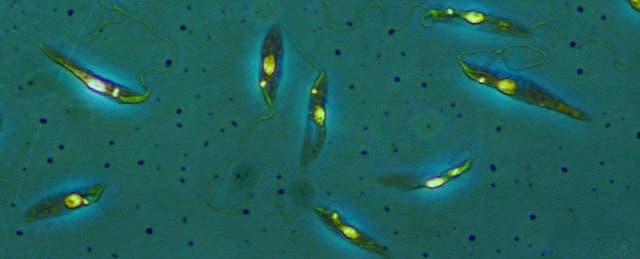 اكتشاف نوع جديد من الطفيليات الخطيرة اكلة اللحم