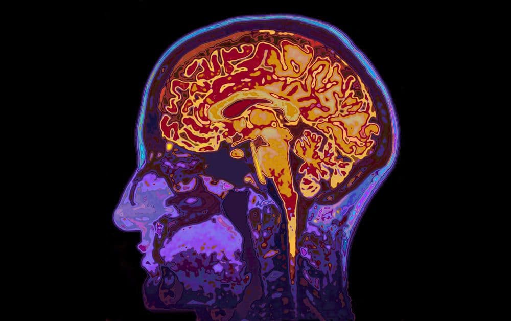أدمغة النساء أكثر شبابًا من أدمغة الرجال