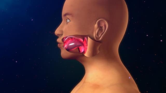 الوذمة الوعائية العصبية Angioedema