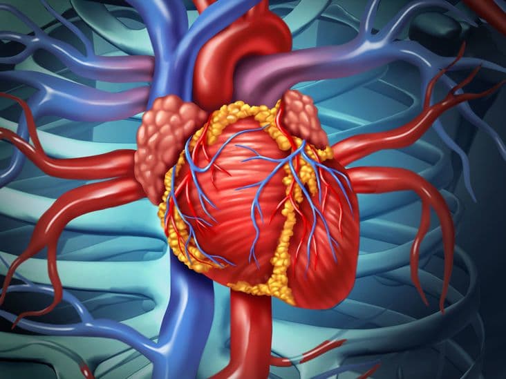 تضيق الصمام التاجي Mitral Valve Stenosis