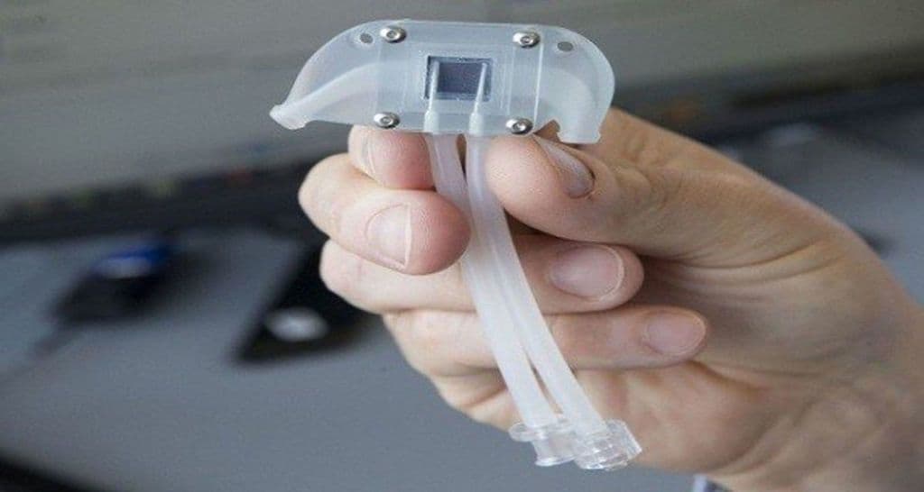 لا مزيد من غسيل الكلى، لقد طور العلماء الكلية الاصطناعية