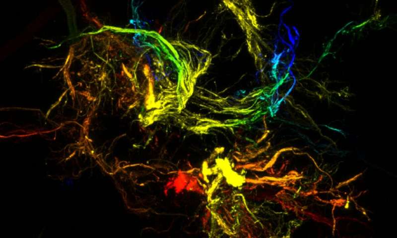 تشكُل جسيمات شجرية فريدة عن طريق اضطراب السوائل