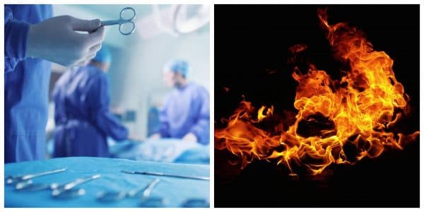 وفاة مريضة سرطان بعد احتراقها حية على طاولة عمليات الجراحة