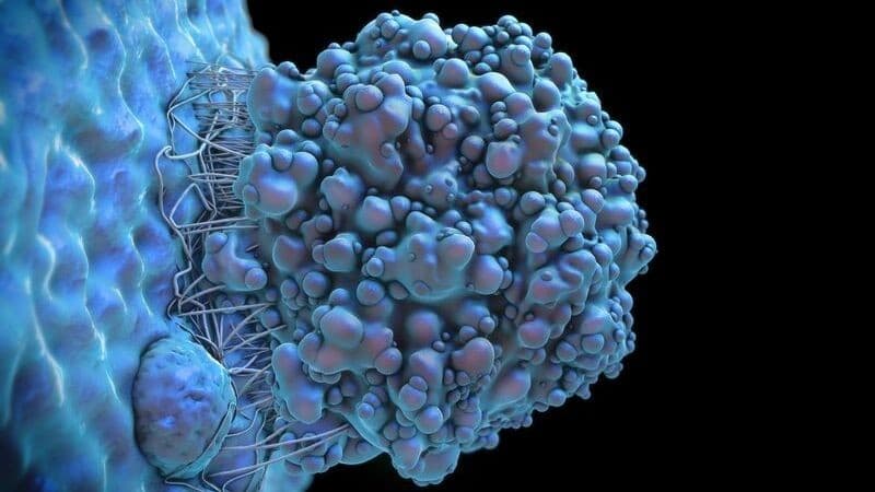 جسيمات نانوية توفر علاجًا بمورثة انتحارية لأورام دماغية طفلية في الفئران