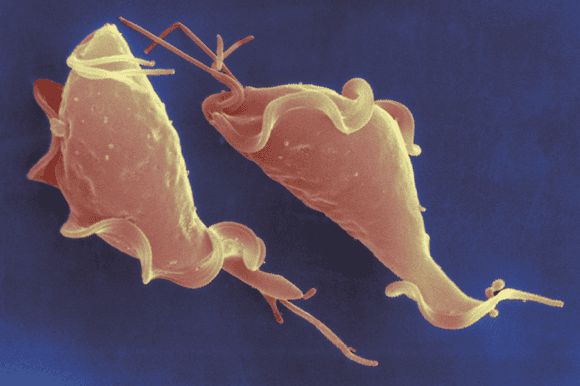 داء المشعرات Trichomoniasis الأسباب والأعراض والتشخيص والعلاج