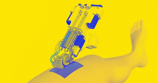 نجاح تجربة طباعة جلد جديد بدلًا من الجلد المحروق