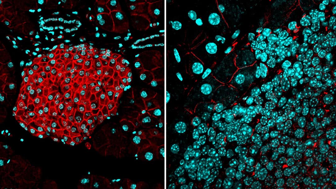 دراسة جديدة ضخمة للجينوم تكشف أسرارًا غامضة عن كيفية تشكل الأورام السرطانية