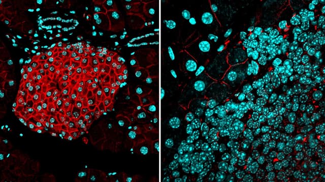 دراسة جديدة ضخمة للجينوم تكشف أسرارًا غامضة عن كيفية تشكل الأورام السرطانية