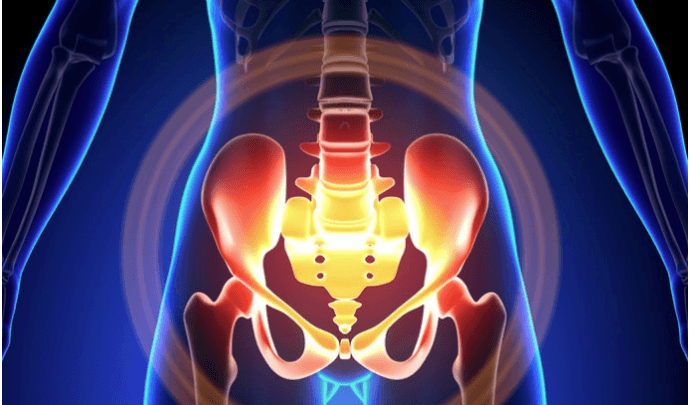 ألم الحوض: الأسباب والعلاج