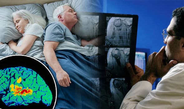 دراسة تؤكد العلاقة بين انقطاع التنفس في أثناء النوم وداء ألزهايمر