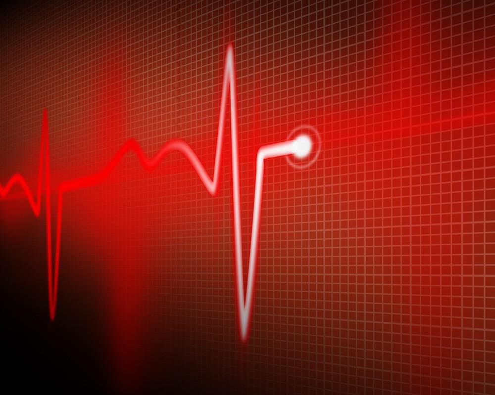 قد تكون مميعات الدم خيارًا أفضل من الوارفارين لمرضى الرجفان الأذيني