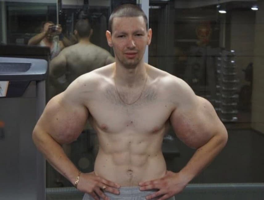 حقن السينثول