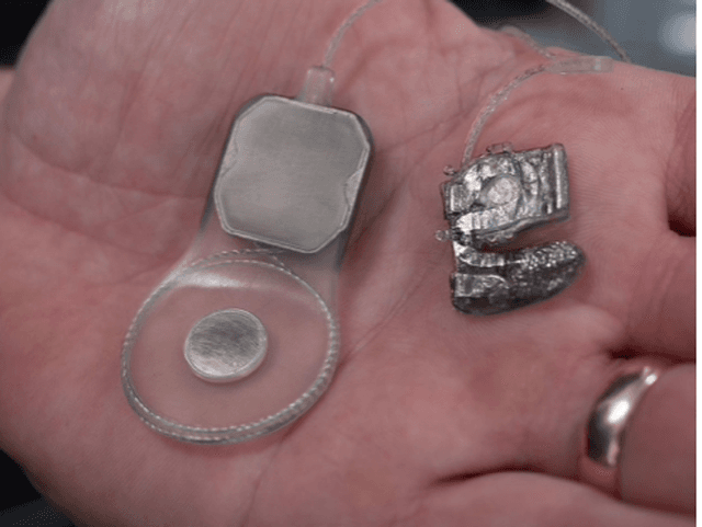 عين إلكترونية في طريقها نحو التجارب البشرية لتحملَ أملًا لمرضى العمى