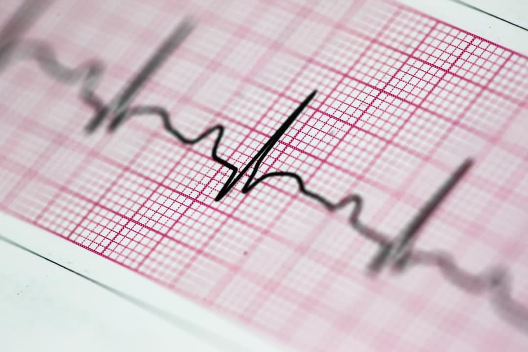 اضطراب النظم الجيبي: الأسباب والأعراض والتشخيص والعلاج