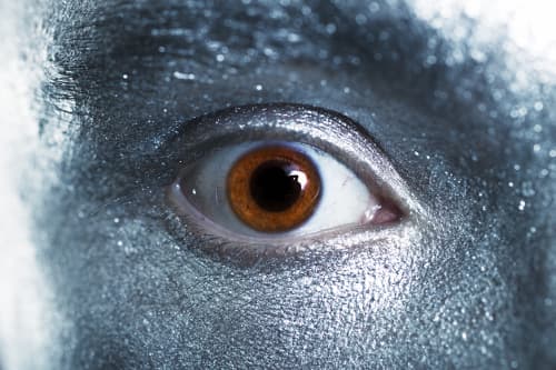 التفضض (التصبغ بالفضة): ما هو مرض السنافر؟