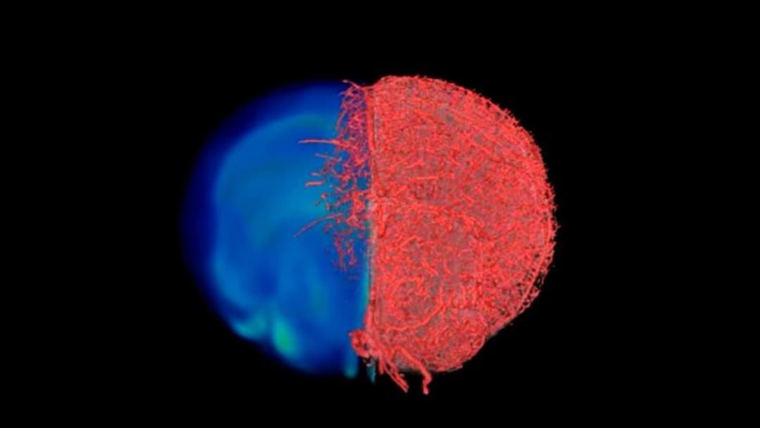 تقنية جديدة غير مسبوقة لتصوير الأوعية الدموية