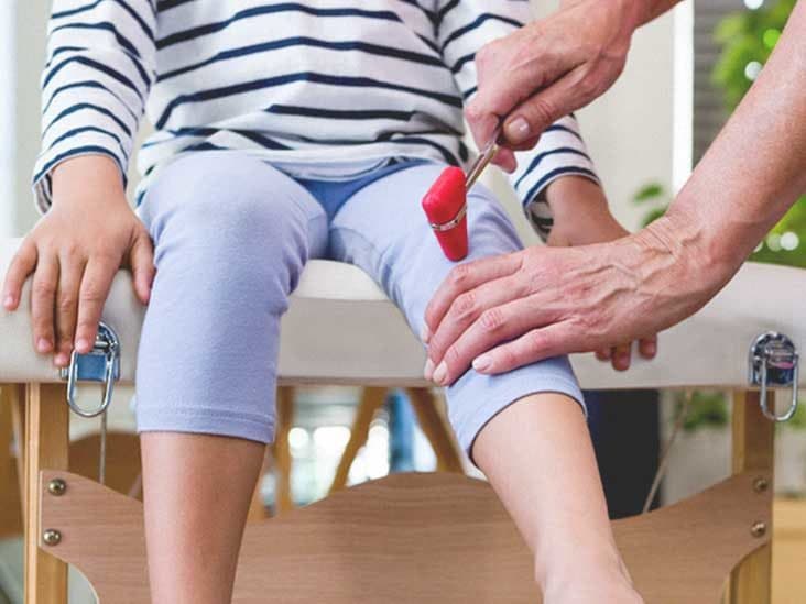 فقد المنعكسات: الأسباب والأعراض والتشخيص والعلاج