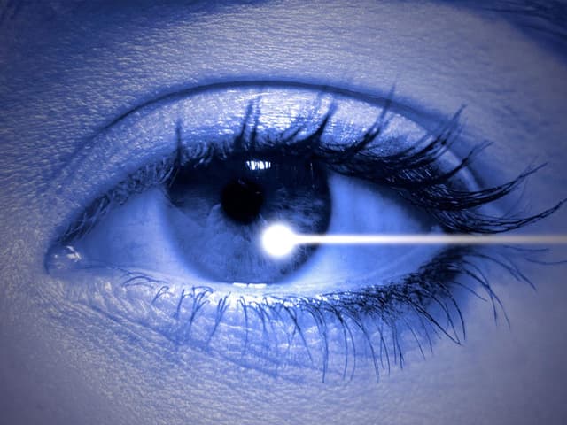 العلاج بليزر الأرغون