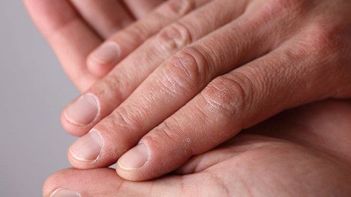 الأظفار والصحة: ماذا تخبرنا أظفارنا عن صحتنا؟