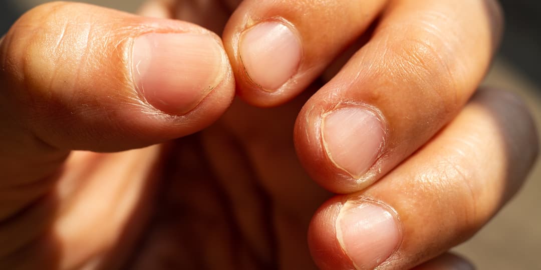 ست معلومات تبينها أظفارك عن حالتك الصحية