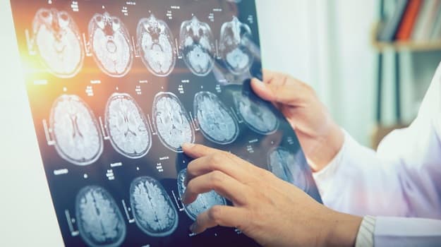 قد يكون أثرياء العالم في الواقع أقل ذكاء وقدرة معرفية من الآخرين