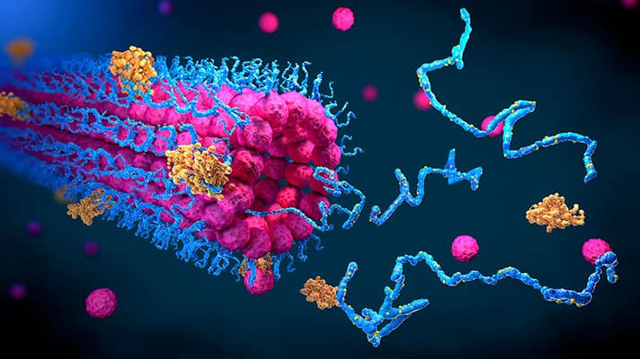 العلماء يشهدون لأول مرة نقطة بداية التحول لمرض ألزهايمر في المختبر