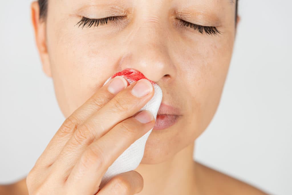 ست خطوات لإيقاف رعاف الأنف (نزف الأنف)