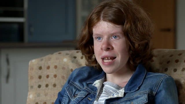 متلازمة ويليامز: الأسباب والأعراض والتشخيص والعلاج