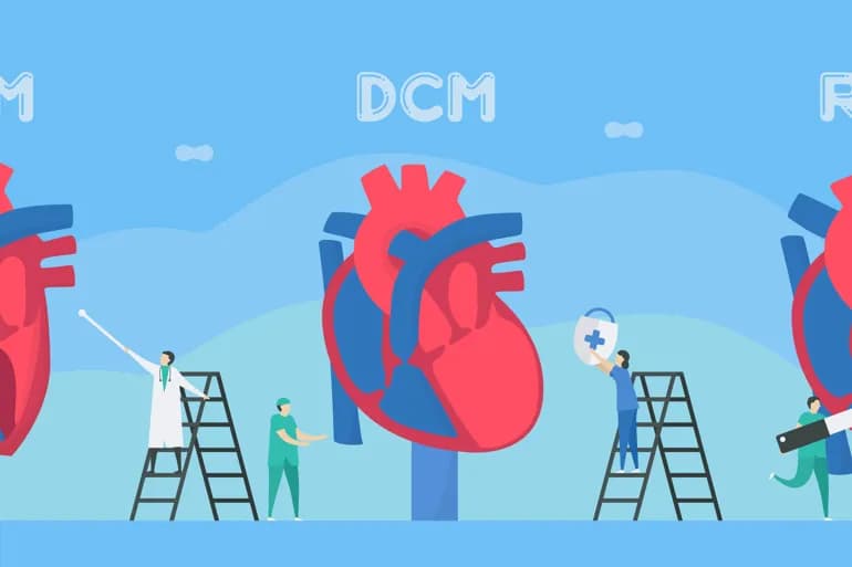 خلل الوظيفة الانبساطية: الأسباب والأعراض والتشخيص والعلاج