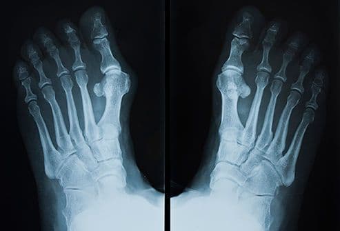 مقبرة قديمة في فنلندا فارغة من الرفات البشرية