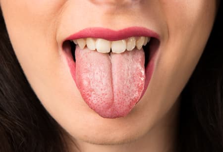 نقص حاسة التذوق: الأسباب والأعراض والتشخيص والعلاج
