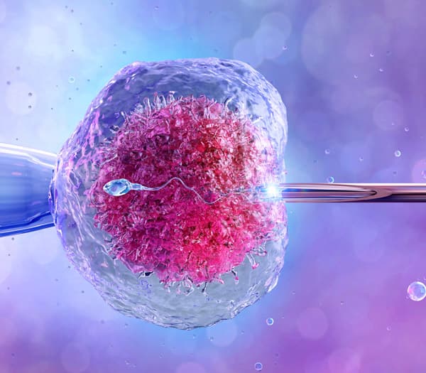 الإخصاب في المختبر (IVF)