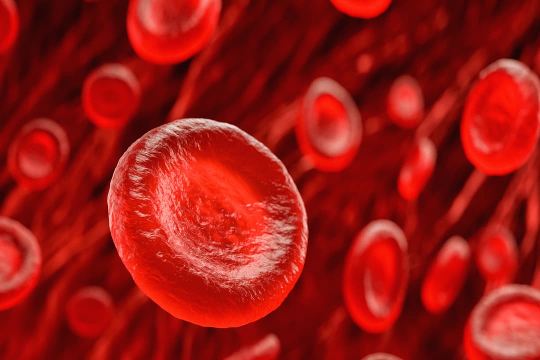 فرفرية قليلة الصفيحات مجهولة السبب