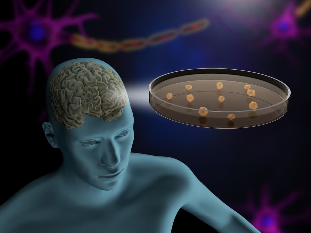 حالة دماغية نادرة لدى رجل تحول الوجوه إلى وحوش