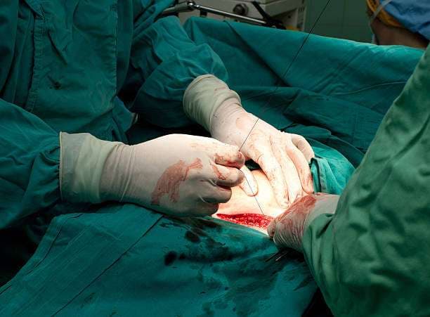 تنظير البطن: الإجراء والاستطباب