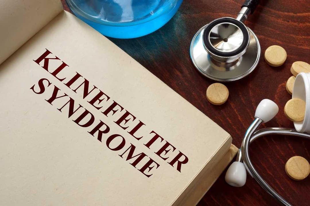 متلازمة كلاينفلتر: الأعراض والعلاج