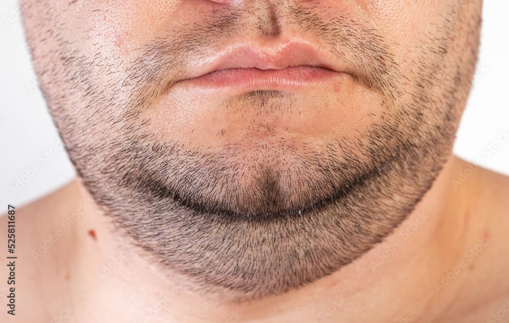 كيف نتخلص من الذقن المزدوجة؟