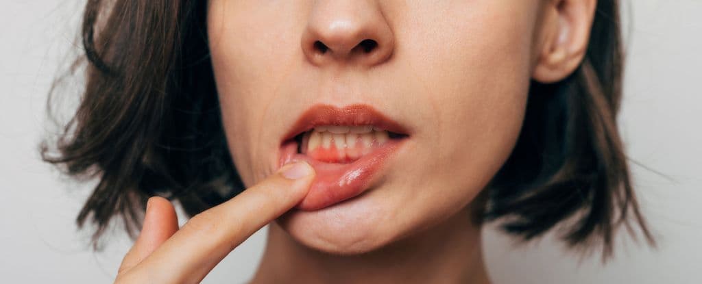 إهمال نظافة الفم قد يزيد مخاطر أمراض القلب